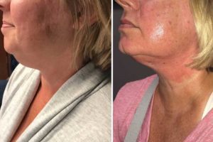 Main Gallery Image 11 | Body Gallery