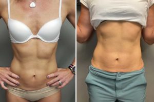 Main Gallery Image 49 | Body Gallery