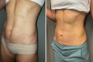 Main Gallery Image 50 | Body Gallery