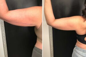 Main Gallery Image 52 | Body Gallery