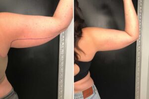 Main Gallery Image 51 | Body Gallery