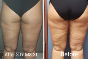 Main Gallery Image 55 | Body Gallery