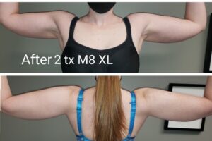 Main Gallery Image 56 | Body Gallery