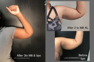 Main Gallery Image 57 | Body Gallery