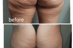 Main Gallery Image 53 | Body Gallery