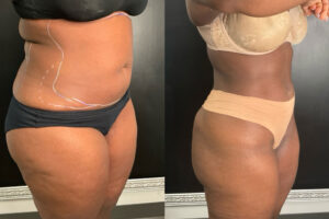 Main Gallery Image 58 | Body Gallery