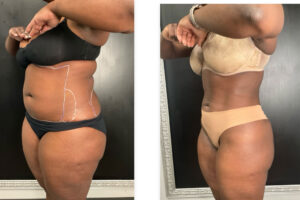 Main Gallery Image 59 | Body Gallery