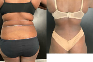 Main Gallery Image 61 | Body Gallery