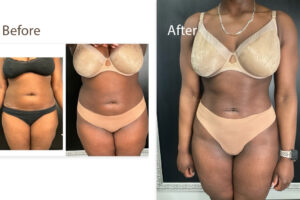 Main Gallery Image 62 | Body Gallery