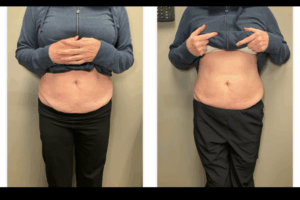 Main Gallery Image 1 | Body Gallery