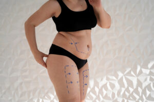 lipo
