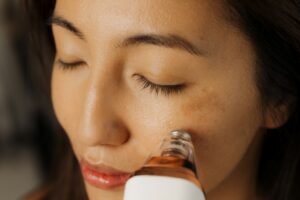 Microneedling