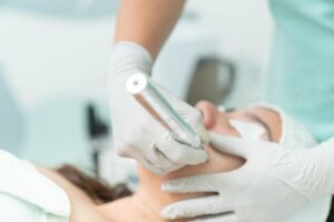 SkinPen Microneedling