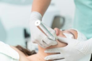 Microneedling